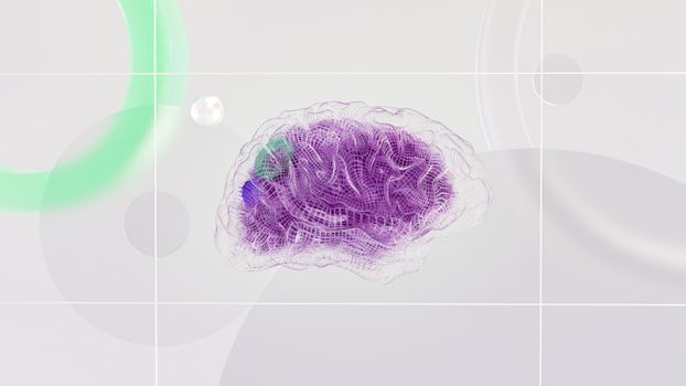 brain implant
